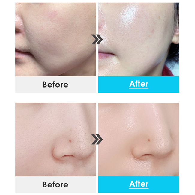 Интенсивно увлажняющий капсульный крем с пептидами - 1 фото галереи Medi-Peel POWER AQUA CREAM (50 мл) - 1 фото галереи